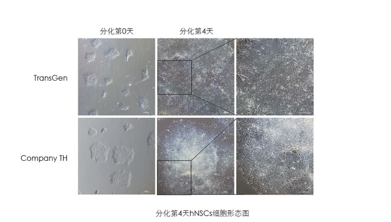 喜訊：全式金獲一項(xiàng)發(fā)明專利授權(quán)--“一種用于人神經(jīng)系統(tǒng)細(xì)胞培養(yǎng)和人多能性干細(xì)胞向神經(jīng)系統(tǒng)細(xì)胞分化的營養(yǎng)添加劑”